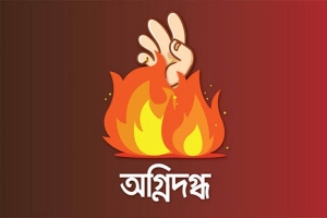 চট্রগ্রামে অগ্নিদগ্ধ হয়ে হবিগঞ্জের ৪ চারজনের মৃত্যু