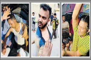শিল্পী সমিতির শপথ শেষে এফডিসিতে মারামারি, সাংবাদিকসহ আহত ১০